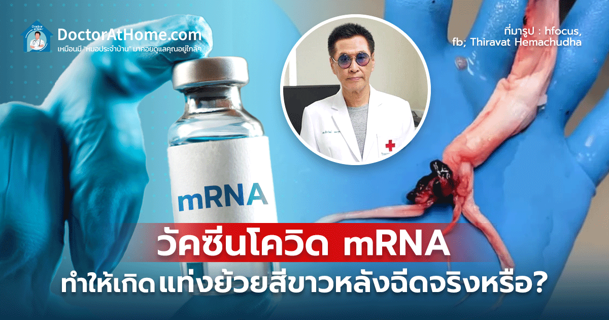 วัคซีนโควิด mRNA ทำให้เกิดแท่งย้วยสีขาวหลังฉีดจริงหรือ?